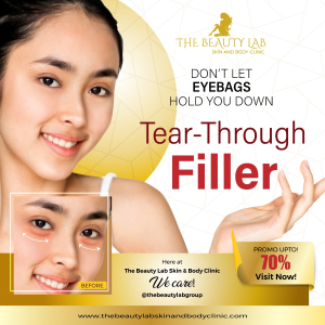 TBL-Tear-Through-Filler-02
